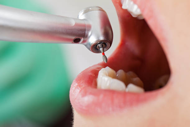 Best Emergency Denture Repair in Sellersburg, IN